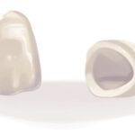 Illustration of 2 dental crowns