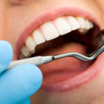 Closeup of a dental mirror examining a woman's tooth enamel