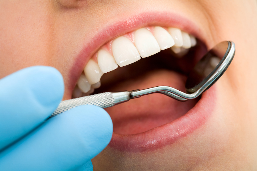 Closeup of a dental mirror examining a woman's tooth enamel