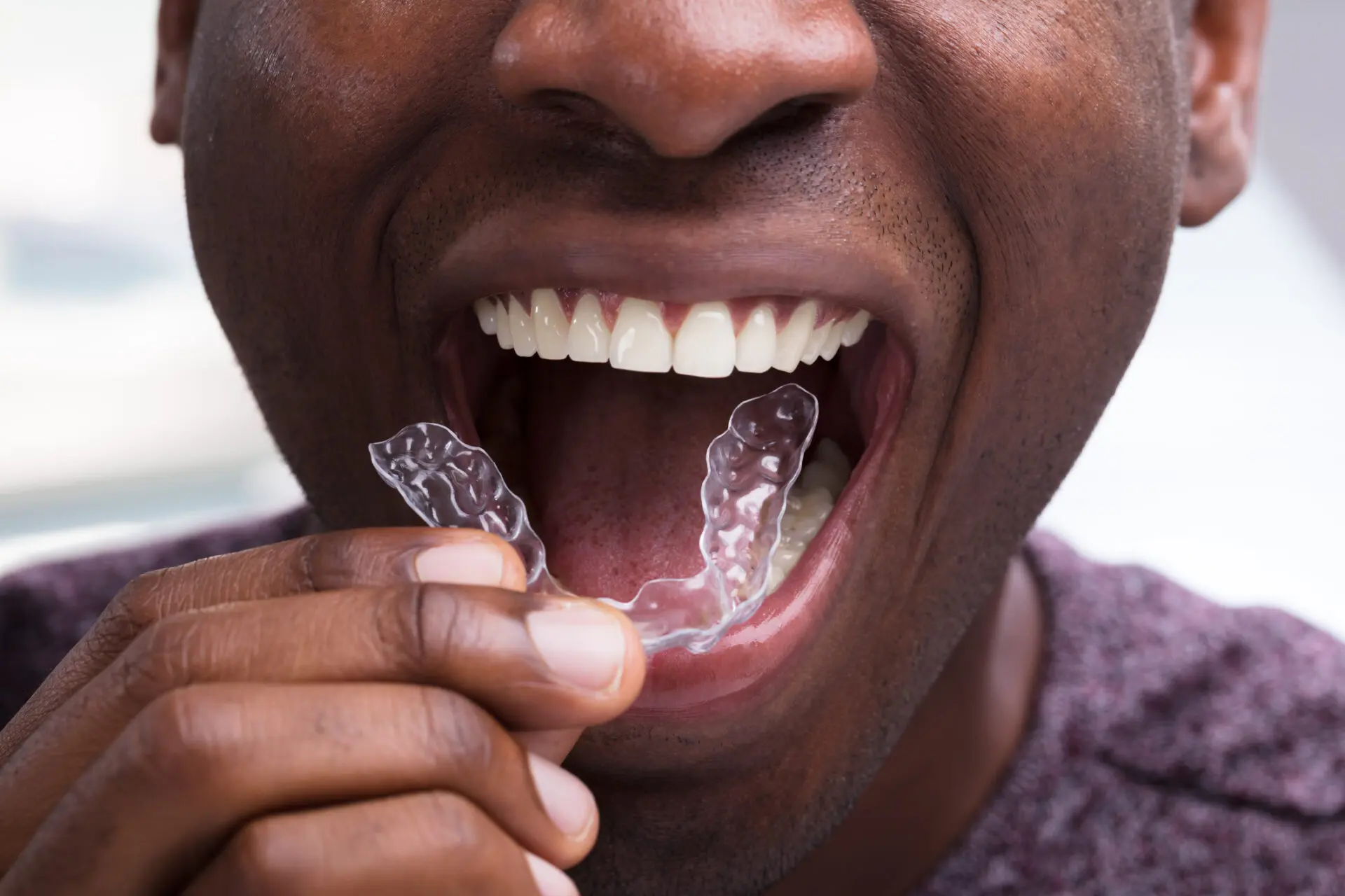 Dental Invisalign Near Me East Rockaway, NY