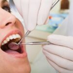 oral cancer signs, oral health, Cullman AL dentist, oral cancer screening, persistent mouth sores, unexplained oral bleeding