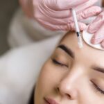 woman getting dermal fillers, common dermal filler myths
